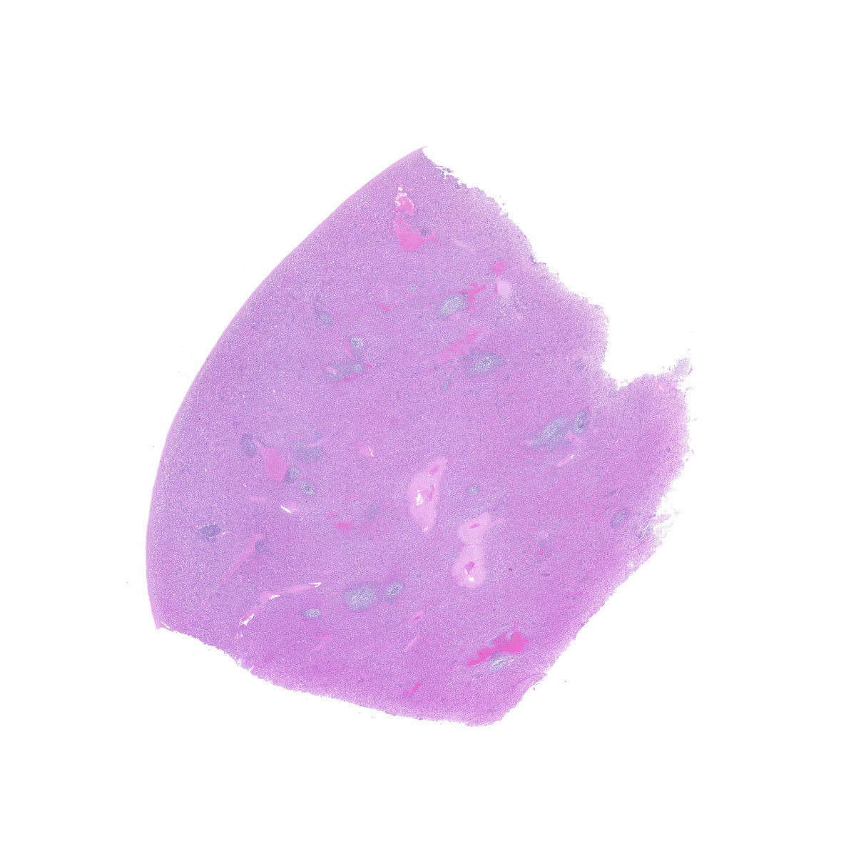 Human FFPE NAT Spleen Tissue HuN-28-0022