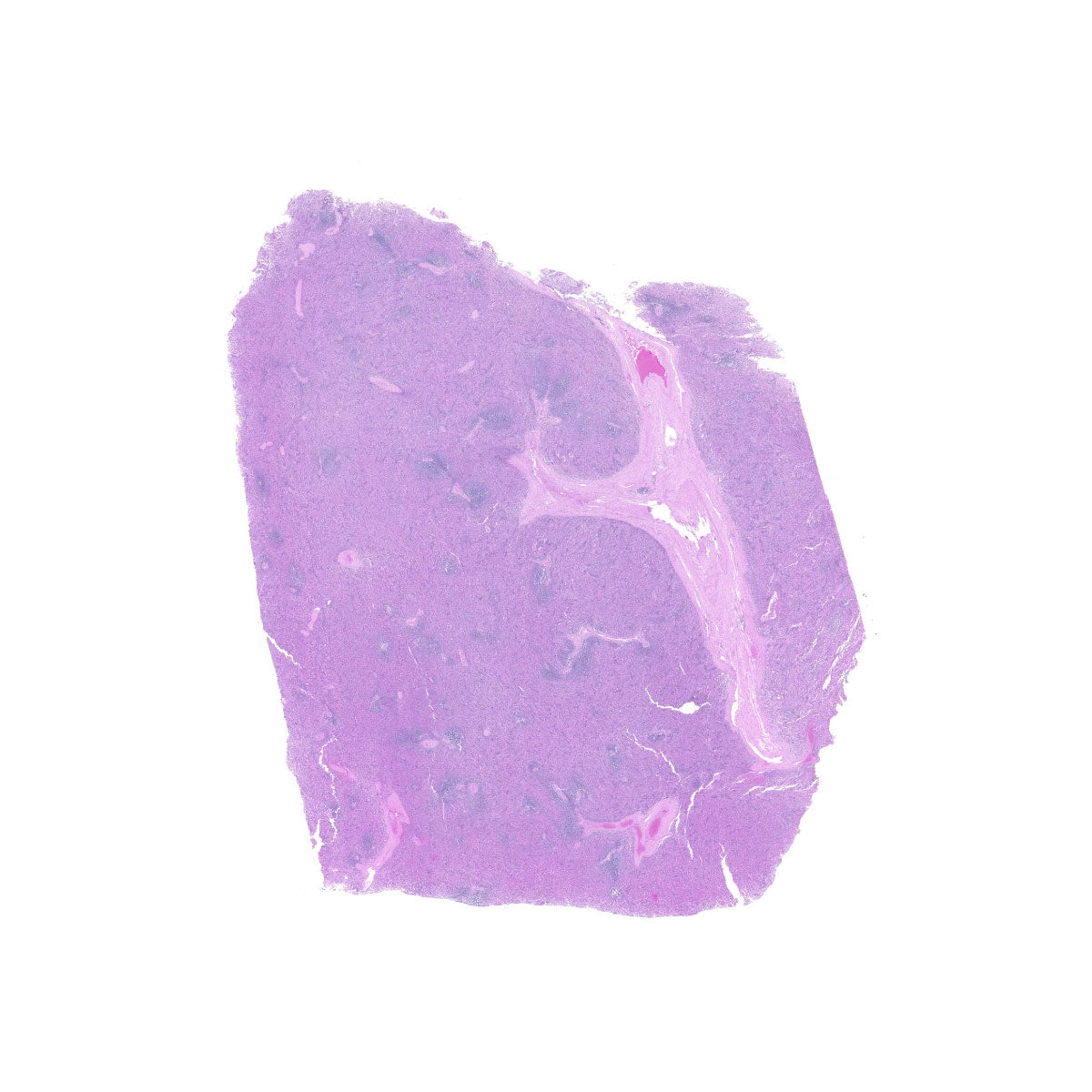 Human FFPE NAT Spleen Tissue HuN-28-0023