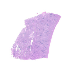 Human FFPE NAT Spleen Tissue HuN-28-0026