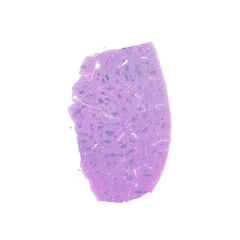 Human FFPE NAT Spleen Tissue HuN-28-0027