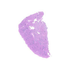 Human FFPE NAT Spleen Tissue HuN-28-0028