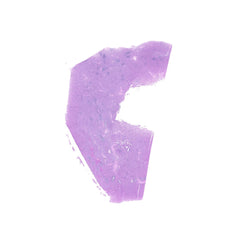 Human FFPE NAT Spleen Tissue HuN-28-0030