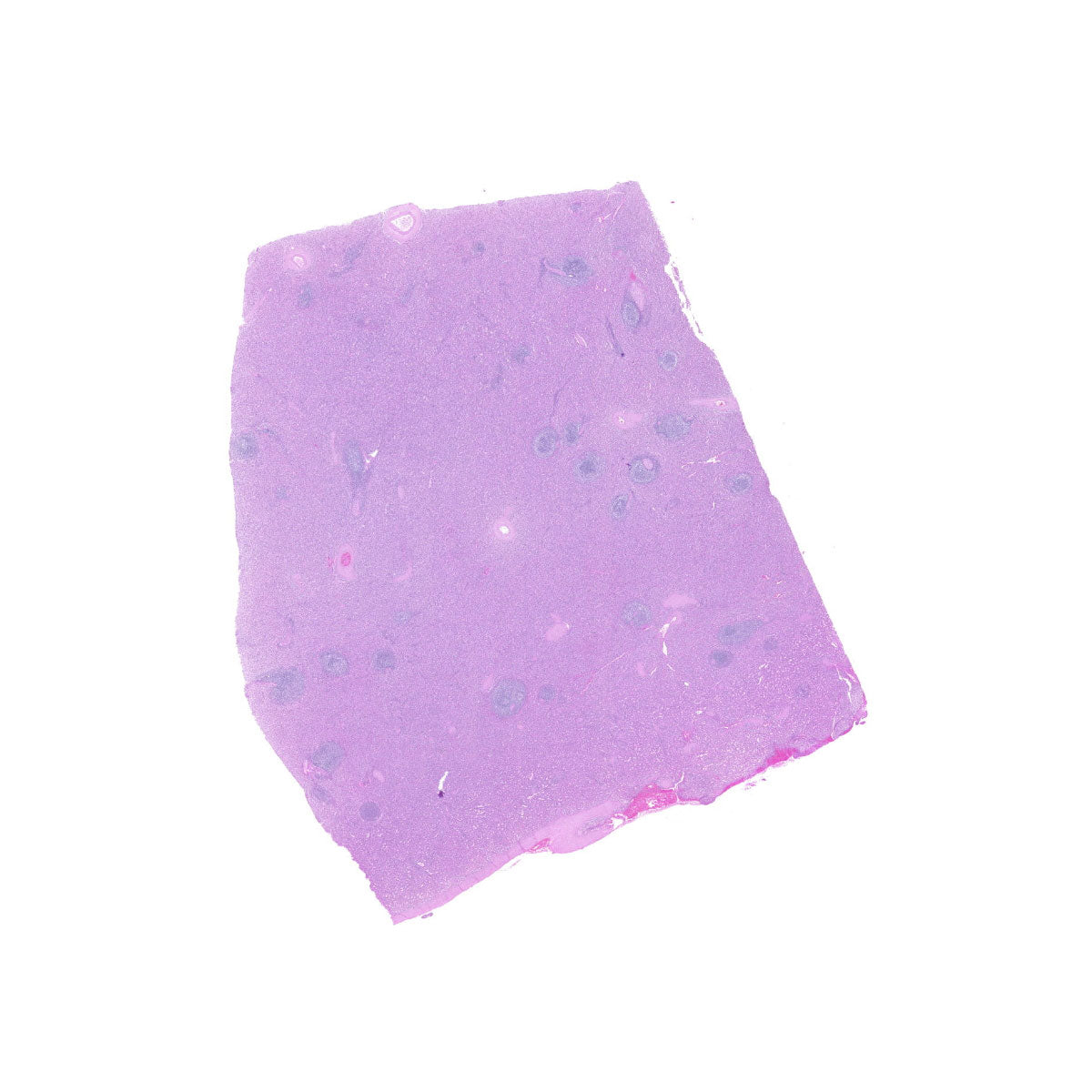 Human FFPE NAT Spleen Tissue HuN-28-0031