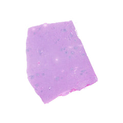 Human FFPE NAT Spleen Tissue HuN-28-0031
