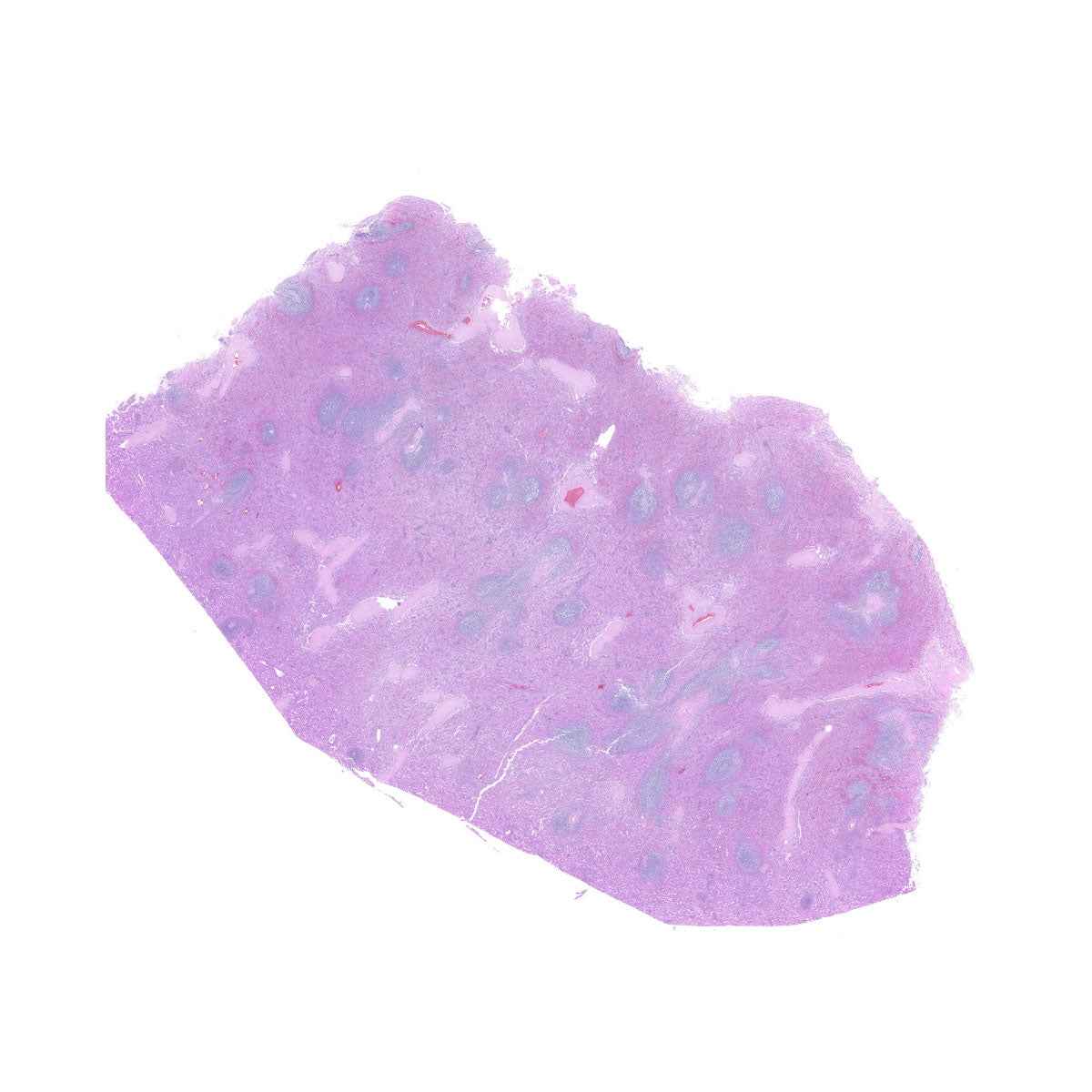 Human FFPE NAT Spleen Tissue HuN-28-0032A