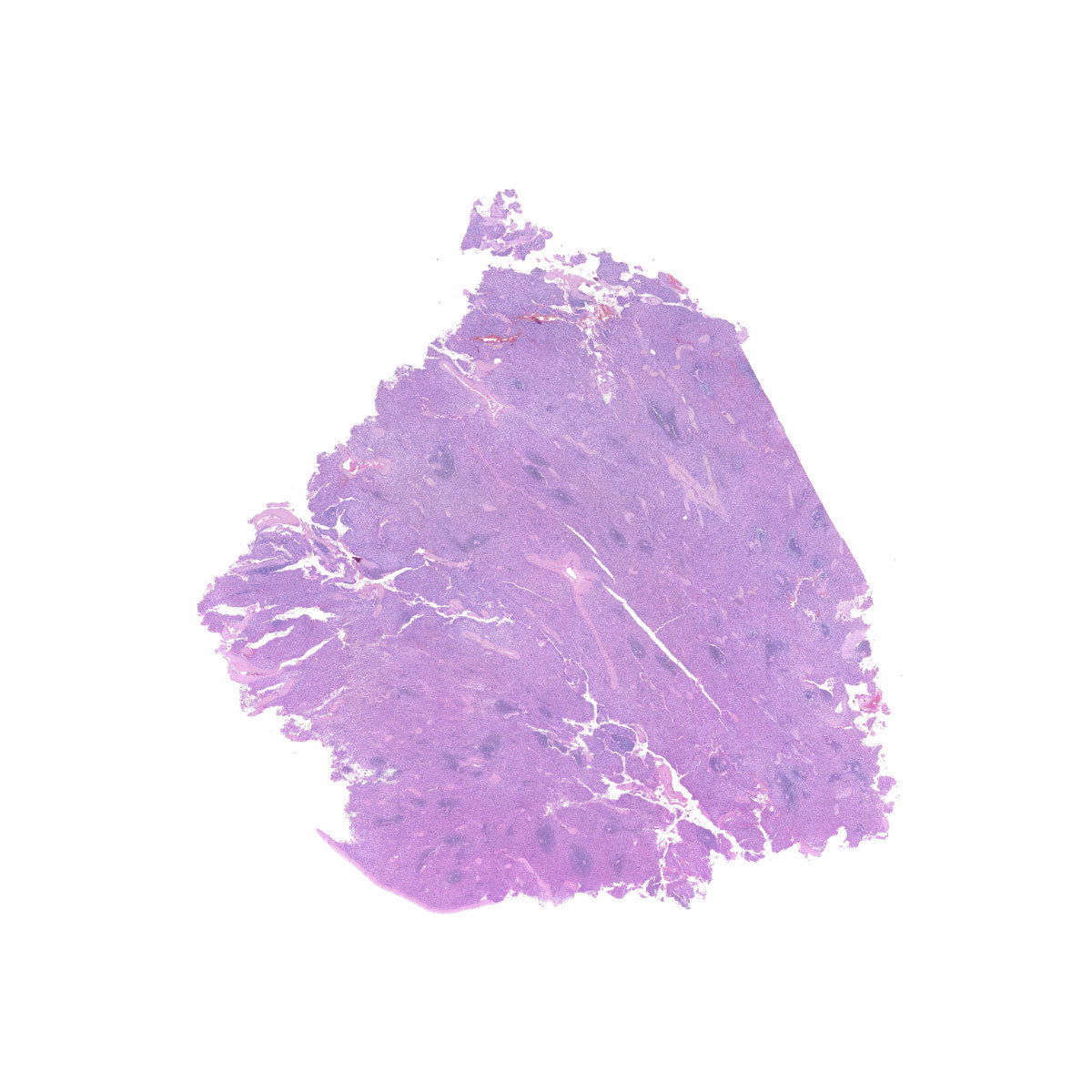 Human FFPE NAT Spleen Tissue HuN-28-0032B