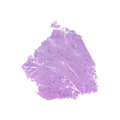 Human FFPE NAT Spleen Tissue HuN-28-0032B