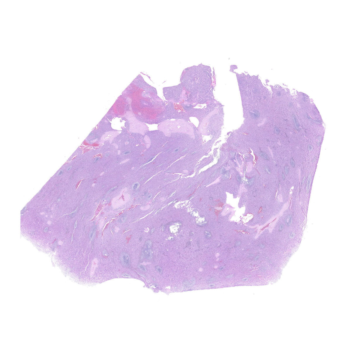 Human FFPE NAT Spleen Tissue HuN-28-0033
