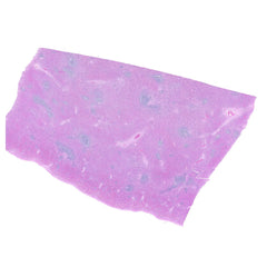 Human FFPE NAT Spleen Tissue HuN-28-0034A