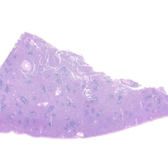 Human FFPE NAT Spleen Tissue HuN-28-0034B