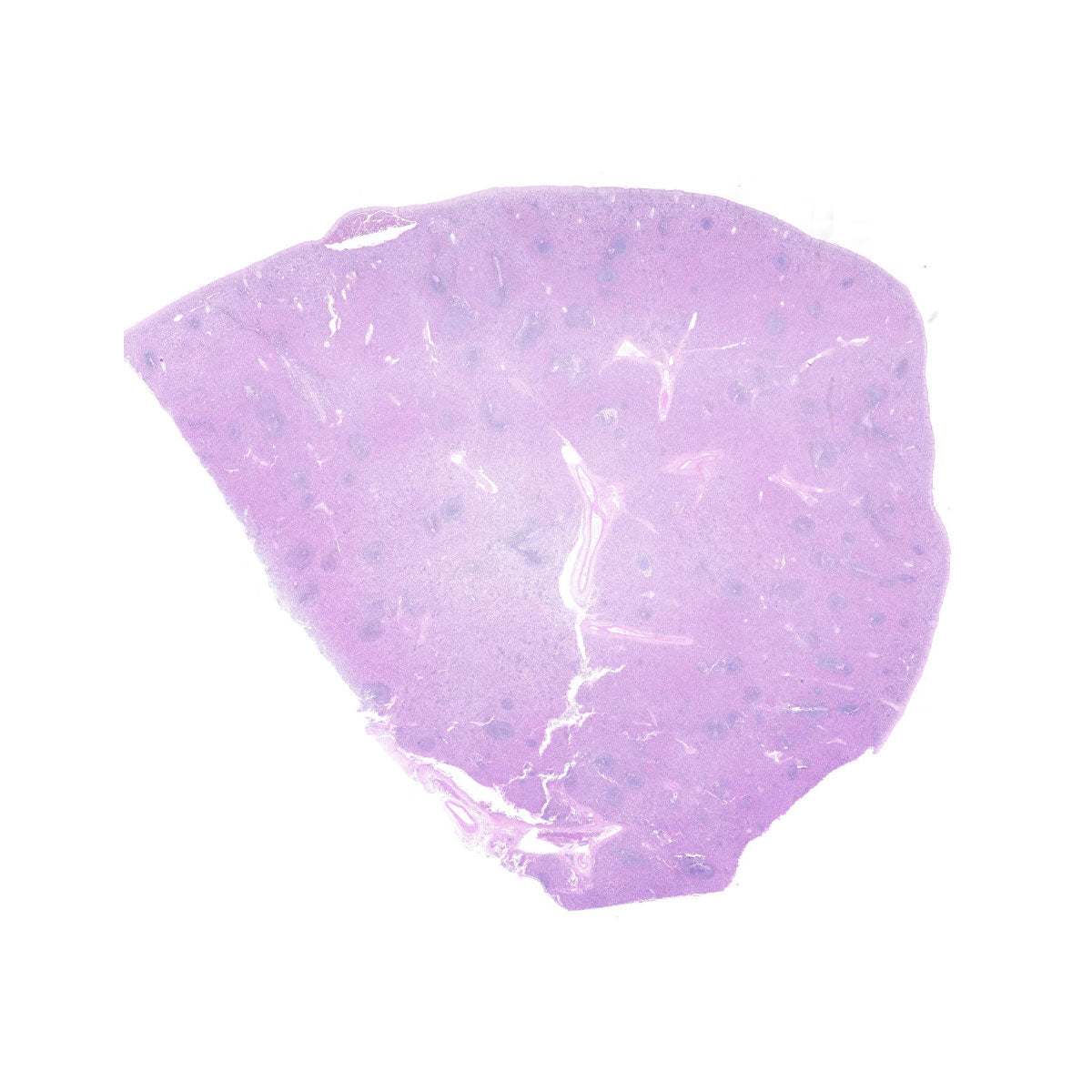 Human FFPE NAT Spleen Tissue HuN-28-0035