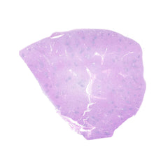 Human FFPE NAT Spleen Tissue HuN-28-0035