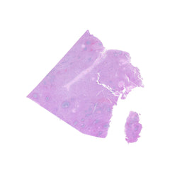 Human FFPE NAT Spleen Tissue HuN-28-0036