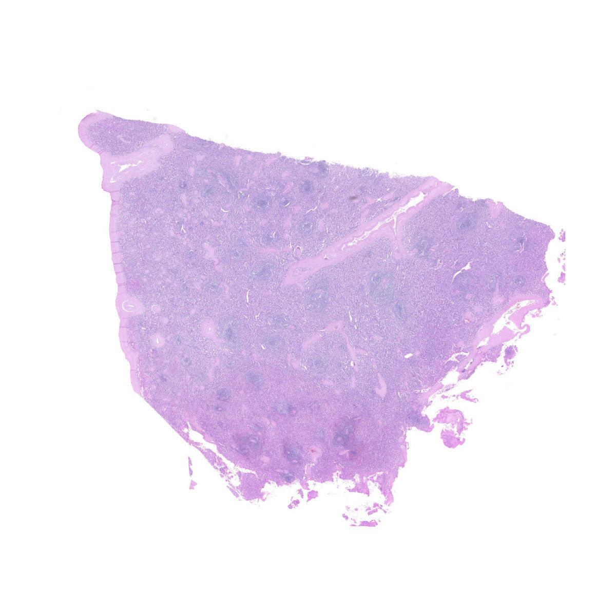 Human FFPE NAT Spleen Tissue HuN-28-0037B