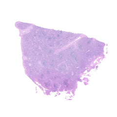 Human FFPE NAT Spleen Tissue HuN-28-0037B
