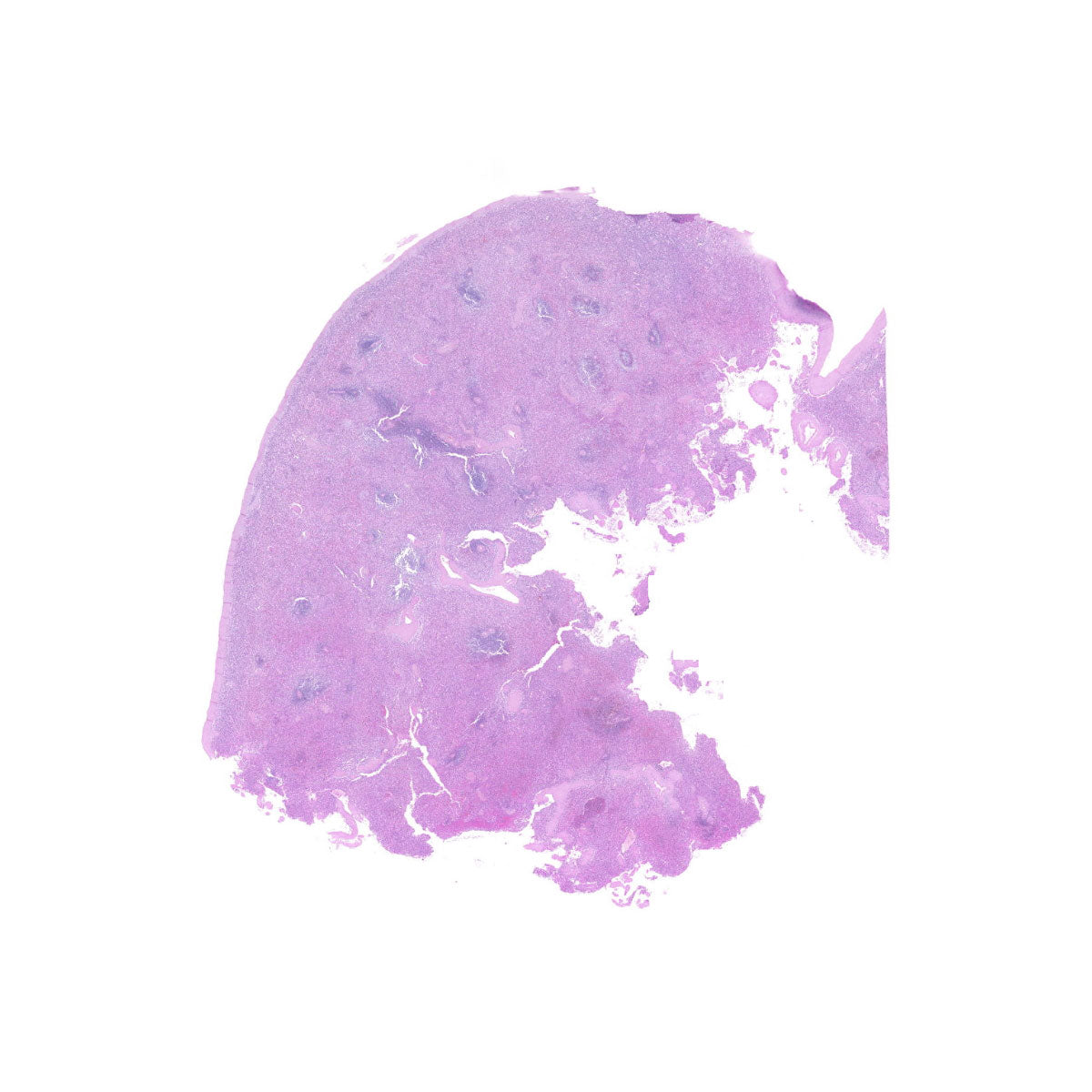 Human FFPE NAT Spleen Tissue HuN-28-0038