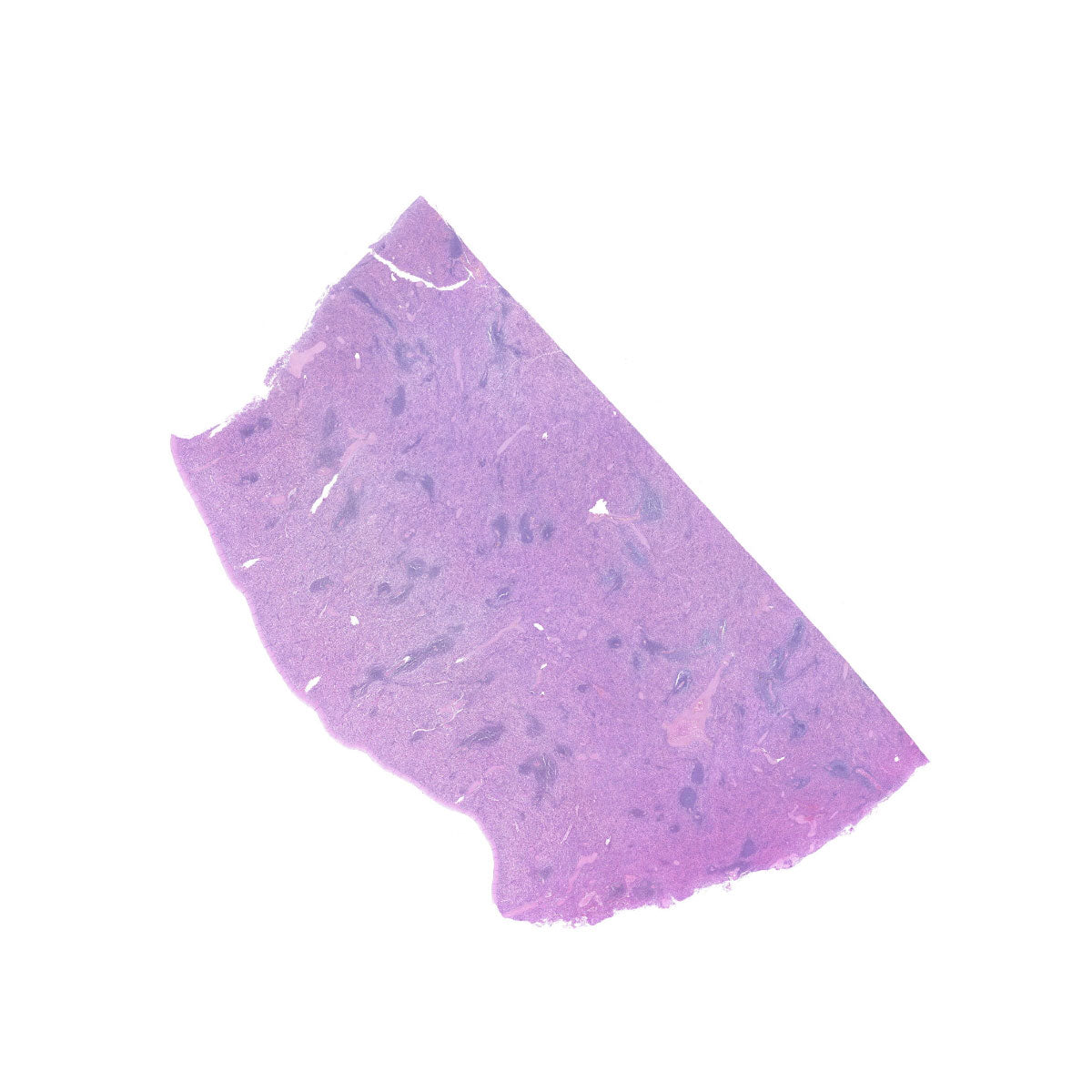 Human FFPE NAT Spleen Tissue HuN-28-0039