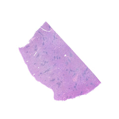 Human FFPE NAT Spleen Tissue HuN-28-0039