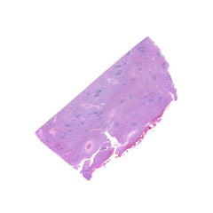 Human FFPE NAT Spleen Tissue HuN-28-0040