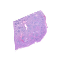 Human FFPE NAT Spleen Tissue HuN-28-0041A