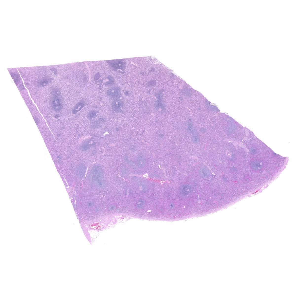 Human FFPE NAT Spleen Tissue HuN-28-0041B