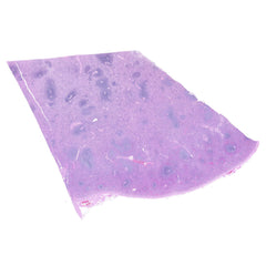 Human FFPE NAT Spleen Tissue HuN-28-0041B