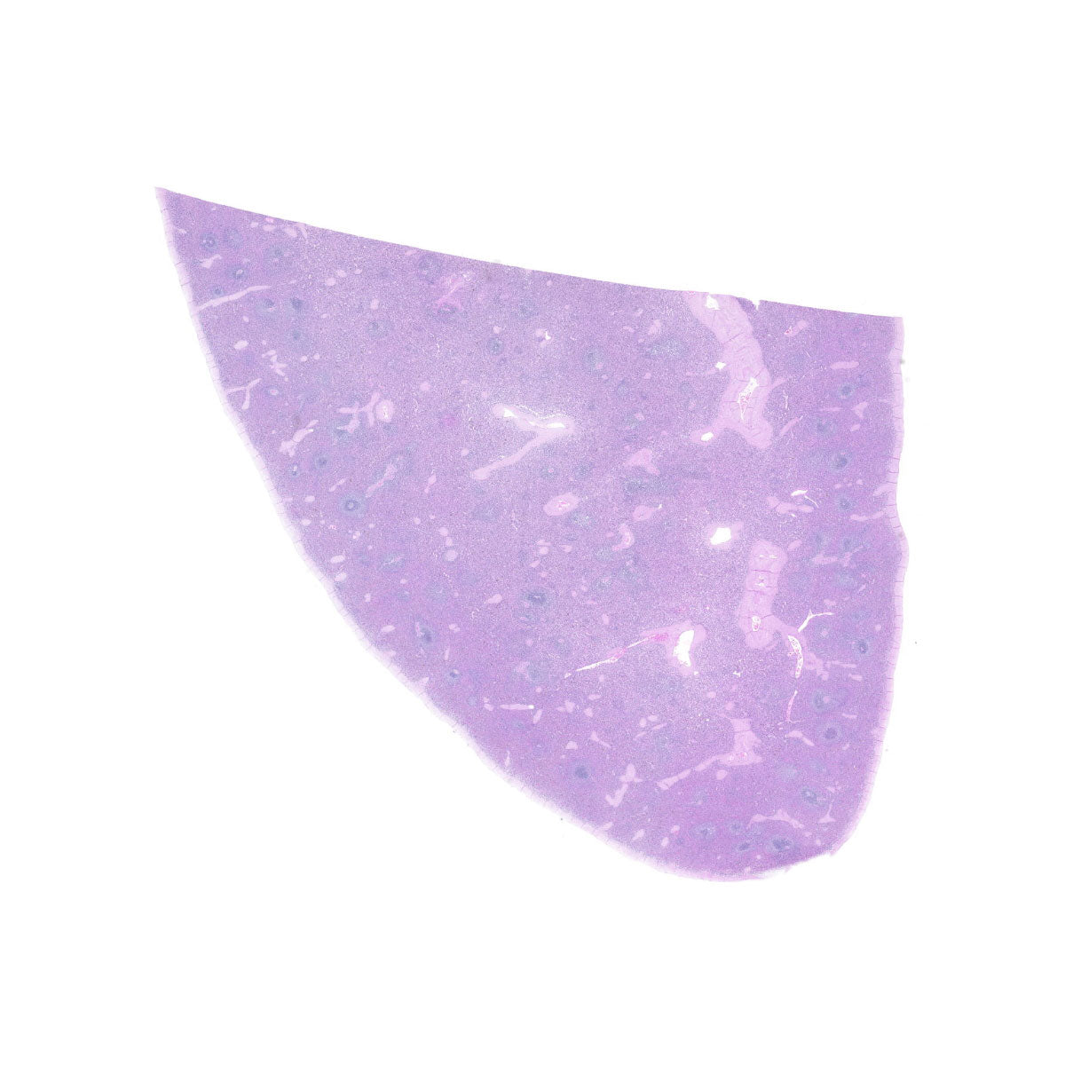 Human FFPE NAT Spleen Tissue HuN-28-0042B
