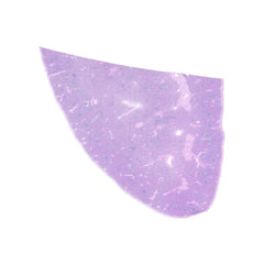 Human FFPE NAT Spleen Tissue HuN-28-0042B